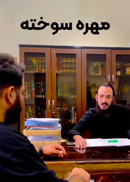 مهره سوخته