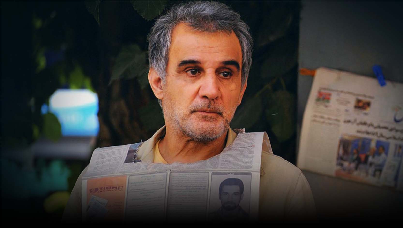 آلزایمر